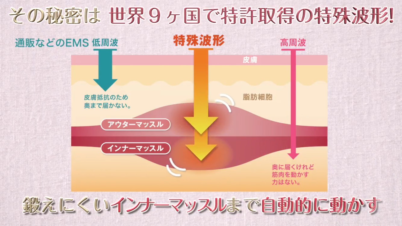 鍛えにくいインナーマッスルまで自動的に動かす"